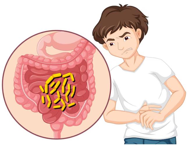 Bệnh Dạ Dày: Viêm Loét, Trào Ngược, Đau Dạ Dày Mãn Tính và Giải Pháp Điều Trị Từ Thuốc Nam Gia Truyền Lan Lệnh