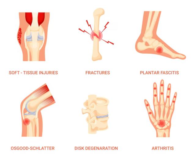 Bệnh Xương Khớp: Nguyên Nhân, Triệu Chứng và Giải Pháp Chữa Trị Hiệu Quả